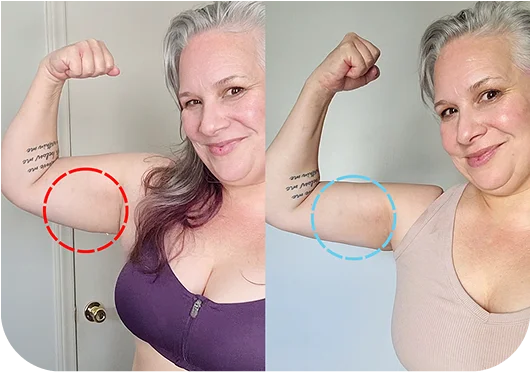MyoGlow before and after - Atena